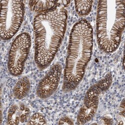 PEPP3 Antibody, Novus Biologicals:Antibodies:Primary Antibodies